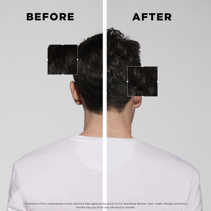 Back view of a male model’s hair before and after using the full Kérastase Spécifique line — showing healthier scalp and improved hair condition.
